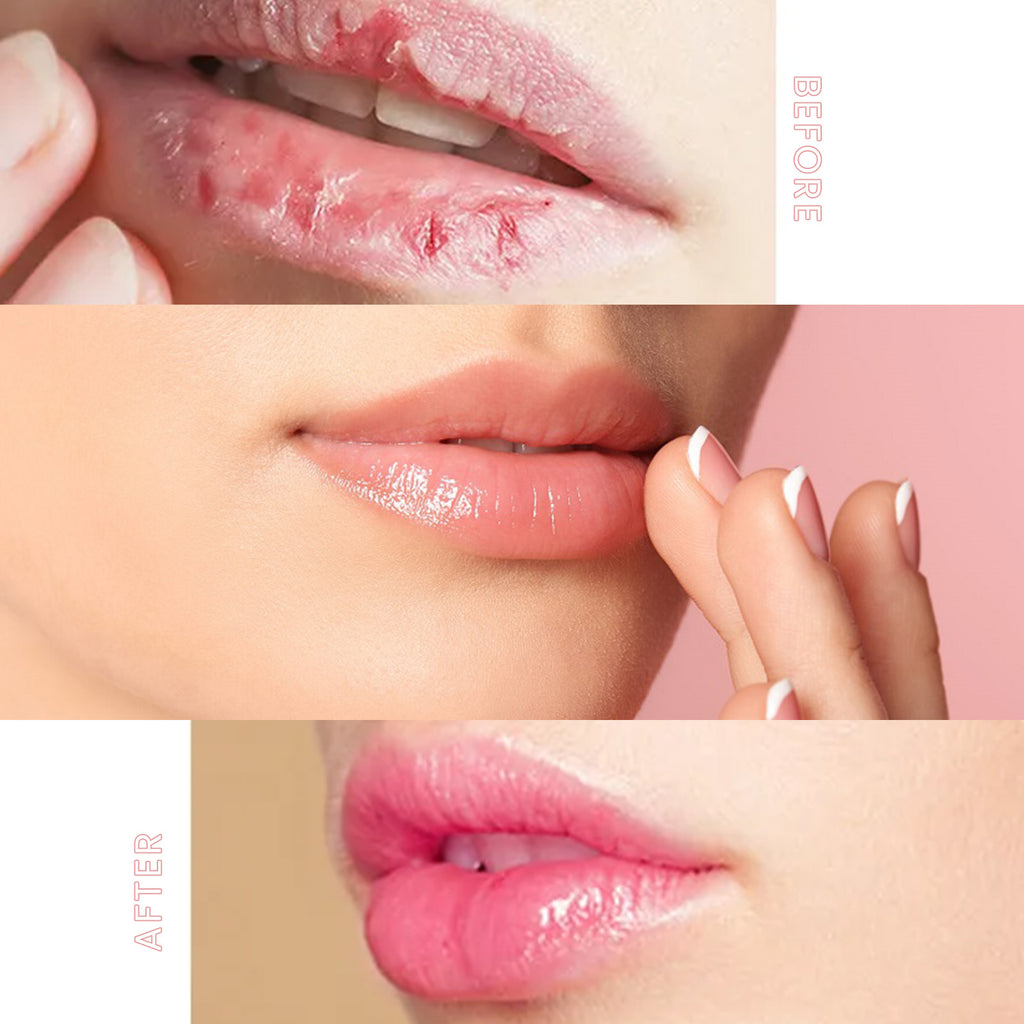 Dreamy Lips Overnight Treatment