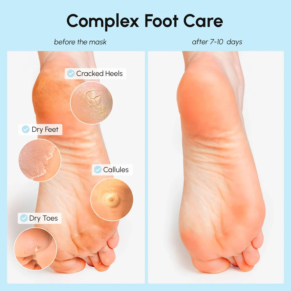 Hydrating Foot Recovery Mask