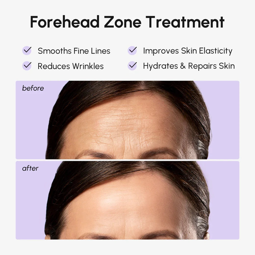 Youthful Glow Forehead Patches